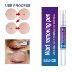 Wart Remover Skin Tag Gel