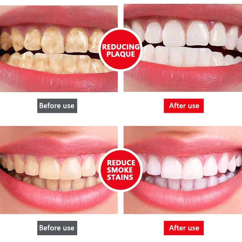 All Smiles- Teeth Whitener, Stain Removing & Bed Breath Removing Toohpaste